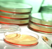 petri dishes